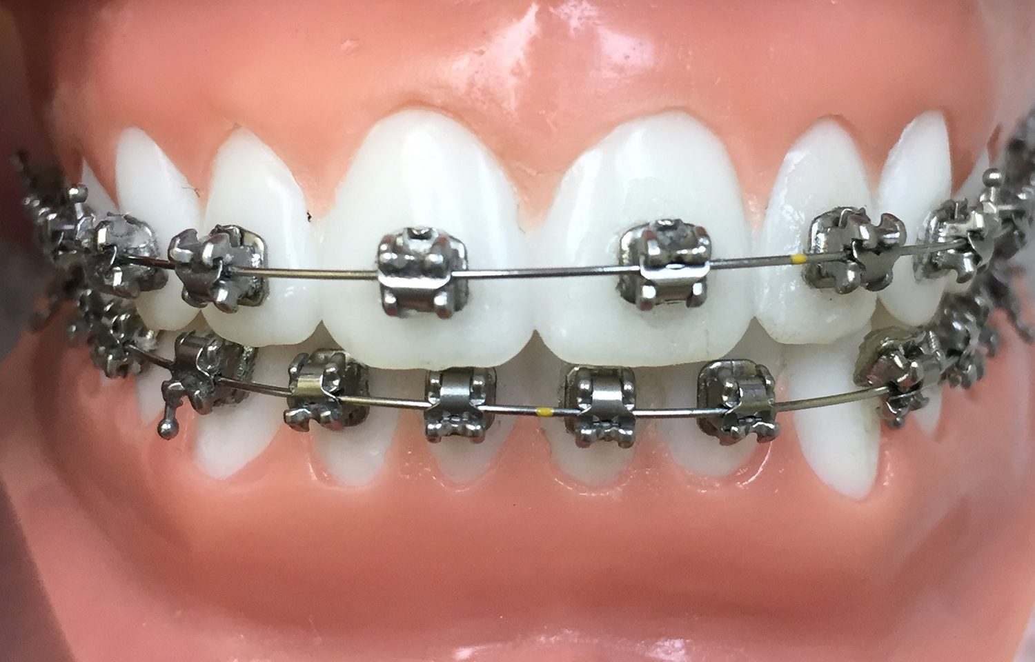 Orthodont