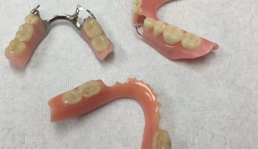 Partial-Dentures